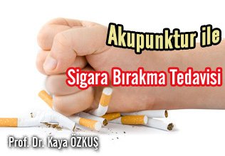 Akupunktur ile sigara bırakma
