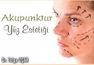 Akupunktur ile yüz estetiği