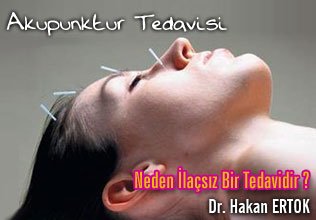 Akupunktur tedavisi neden ilaçsız bir tedavidir ?