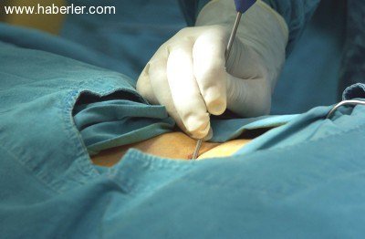 Ameliyatsız bel ve boyun fıtığı tedavisi