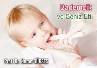 Bademcik  ve geniz eti  büyüklüğü her zaman ameliyat endikasyonu değildir