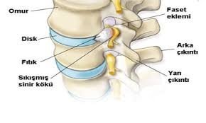 Bel ağrısı nedenleri ve algolojide tedavisi