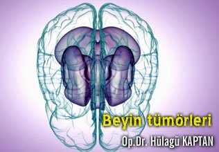 Beyin tümörleri tanı ve tedavisi