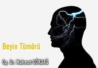 Beyin tümörü