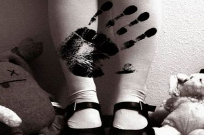 ÇOCUKLARDA CİNSEL İSTİSMAR