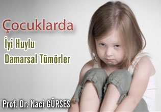 Çocuklarda iyi huylu damarsal tümörler