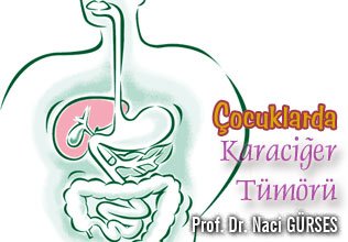 Çocuklarda karaciğer tümörü