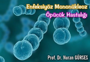 Enfeksiyöz mononükleoz öpücük hastalığı