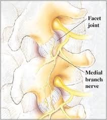 Faset eklem blokajı – faset medial dal blokajı ve rft