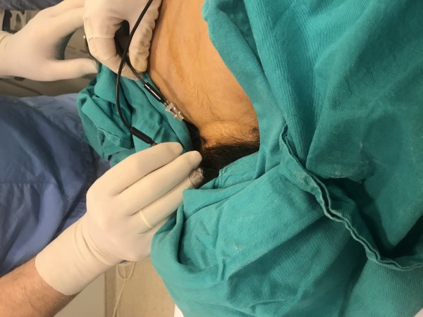 Fibromiyalji hakkında