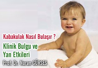 Kabakulak nasıl bulaşır ? Klinik bulgu ve yan etkileri