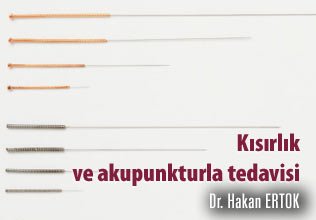 Kısırlık ve akupunkturla tedavisi!