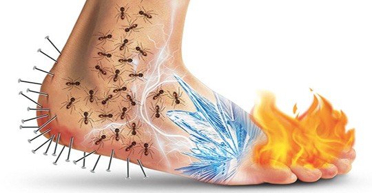 Nöropatik ağrı nedir?