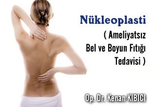 Nükleoplasti (ameliyatsız bel ve boyun fıtığı tedavisi)