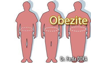 Obezite,