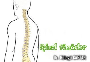 Spinal tümörler