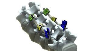 Şu vida dedikleri..