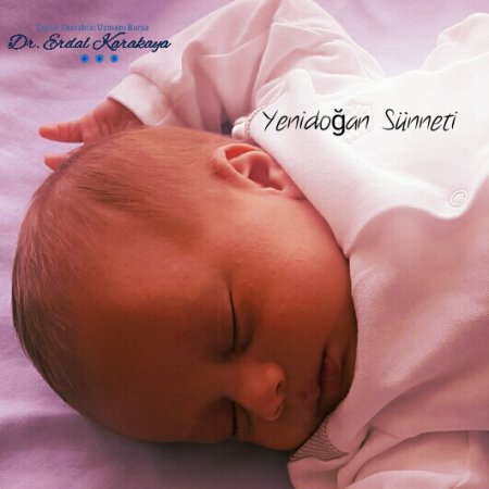 Yenidoğan sünneti yararlı mıdır?