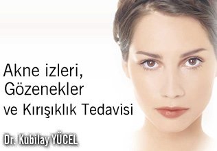 Akne izleri, gözenekler ve kırışıklık tedavisi