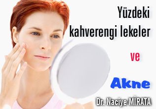 Akne izleri ve yüzdeki kahverengi lekelerin tedavisi