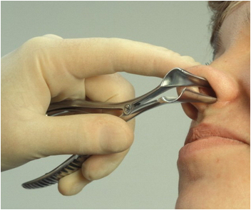 Allerjik rinitler ve tedavisi