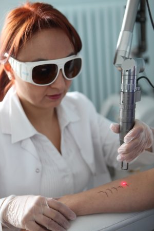 Dövme nedir, nasıl çıkartılır?