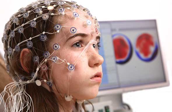 Elektroensefalografi (eeg) nasıl uygulanır?