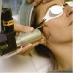 Fraksiyonel co2 lazer nedir ve nasıl çalışır?