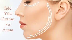 İple yüz gençleştirme hangi bölgelere uygulanır?