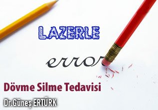 Lazerle  dövme silme tedavisi