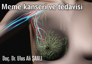 Meme kanseri ve tedavisi