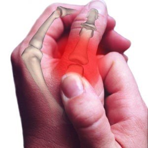Osteoartrit nedir? Nasıl oluşur?