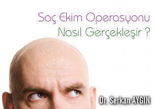 Saç ekim operasyonu nasıl gerçekleşir ?