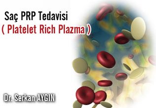 Saç prp tedavisi (platelet rich plazma)